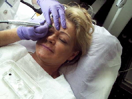 microblading-augenbrauen